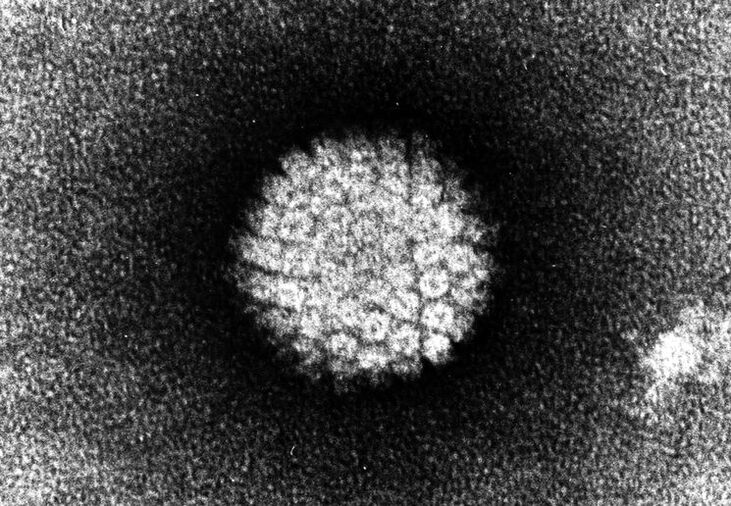Papillomavirus umano che provoca lesioni cutanee