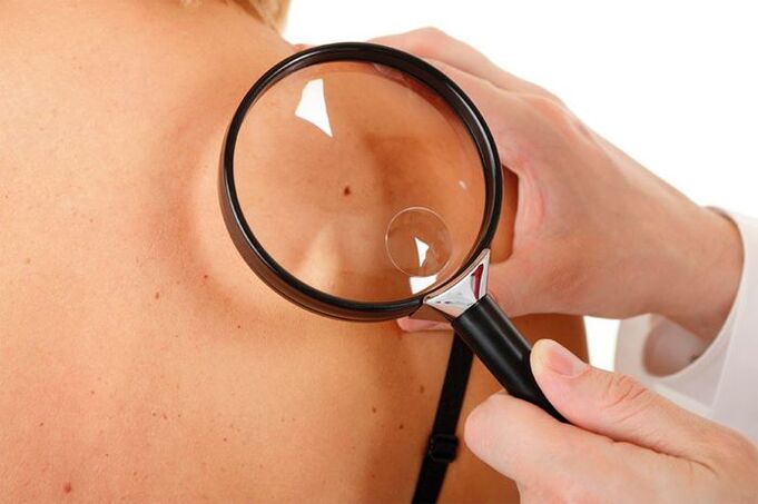 Esame di un paziente con HPV