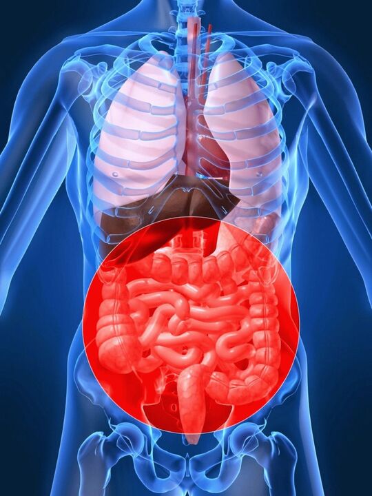 La disbiosi intestinale provoca l'attivazione del papillomavirus umano